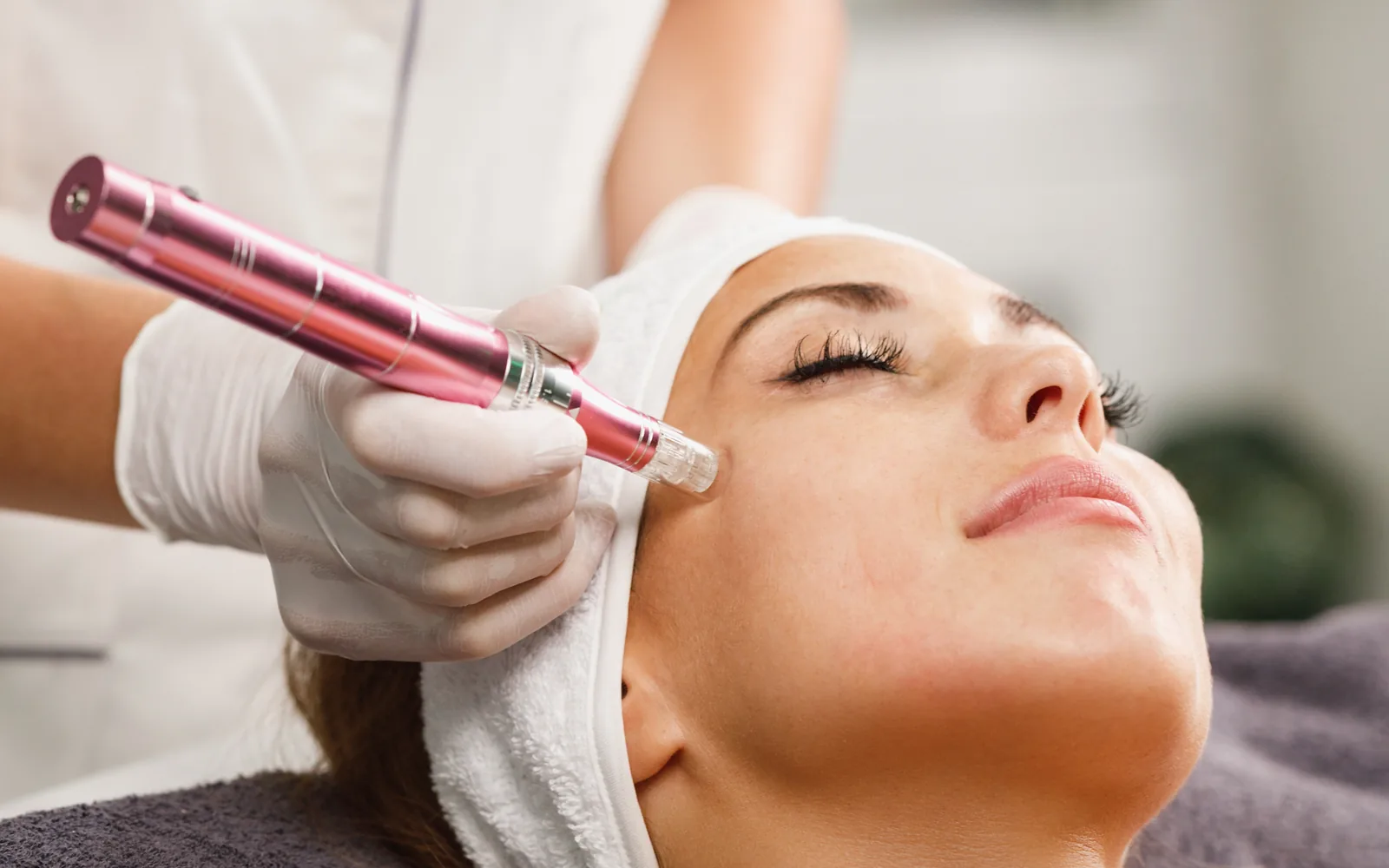Microneedling Behandlung für ein gepflegtes Hautbild bei Home of Beauty Mölln