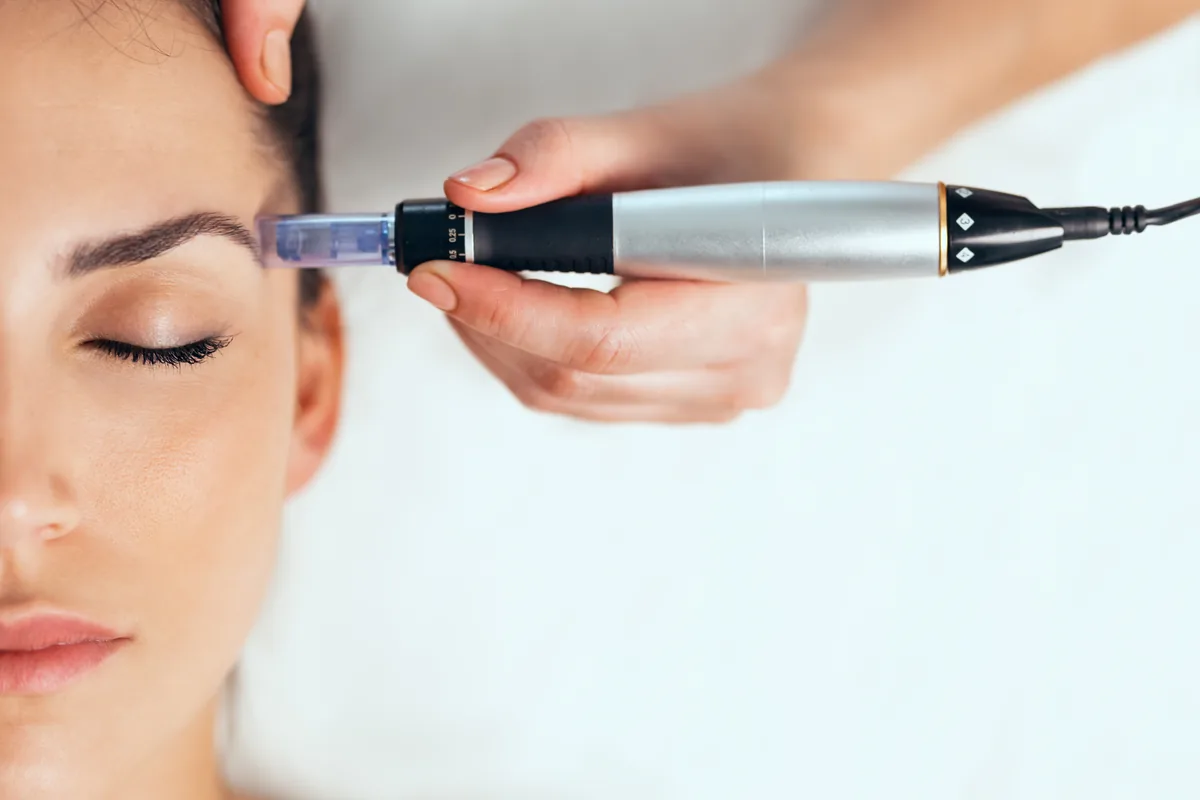 Microneedling Behandlung im Kosmetikstudio Home of Beauty Mölln